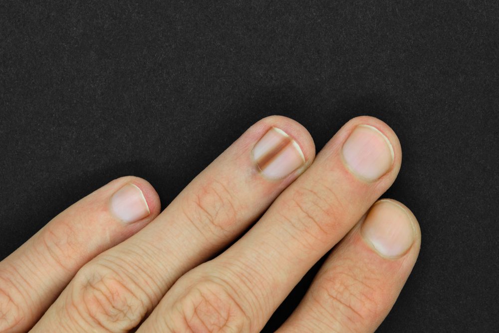 nails