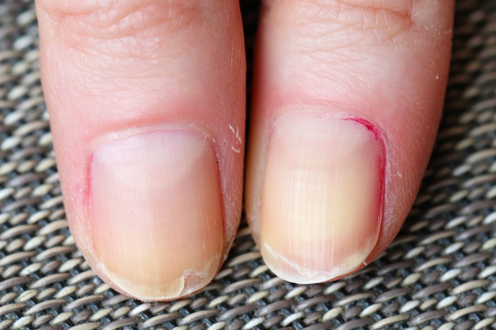 nails