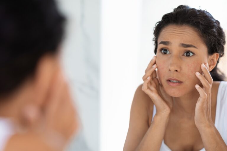 stress affects your skin, collagen supplements