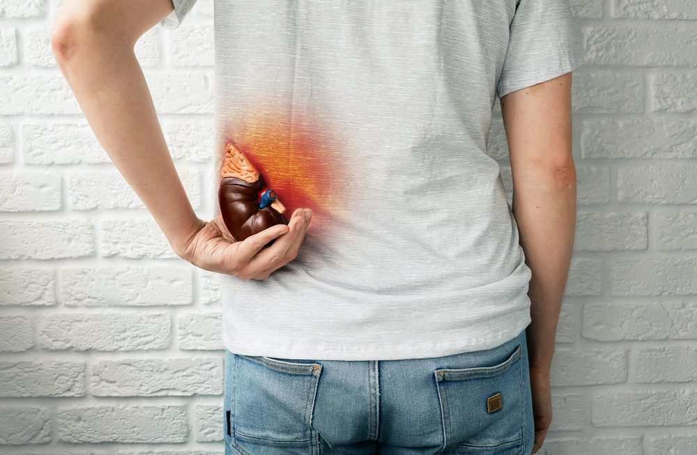 symptoms of kidney stones