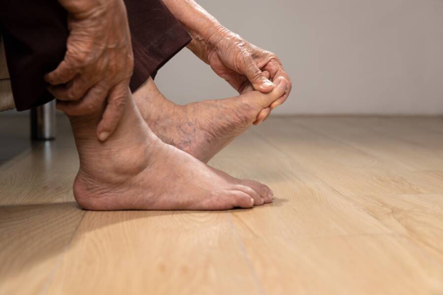 relieve swollen feet